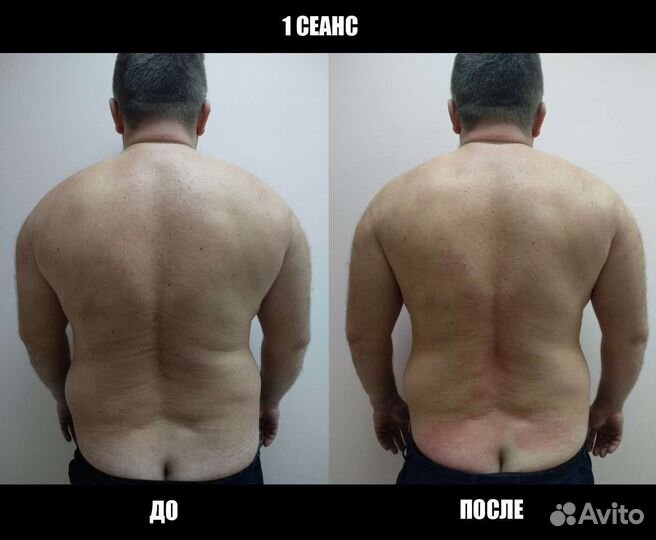 Костоправ Иваново