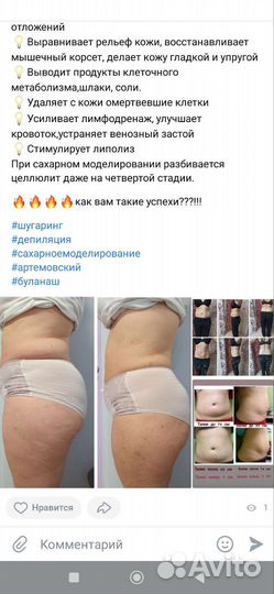 Шугаринг. Сахарное моделирование лица и тела