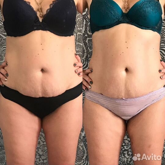 Массаж, похудение