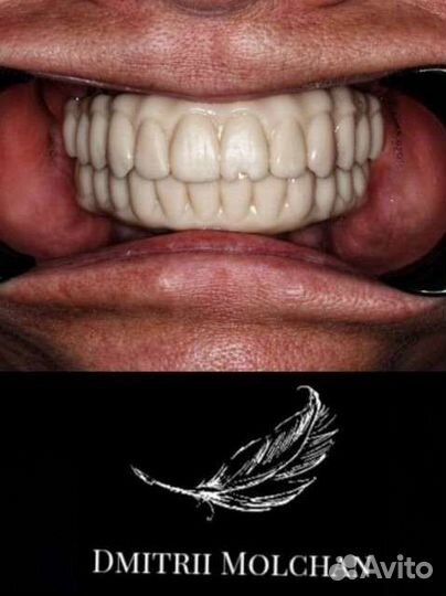 Зубной Техник