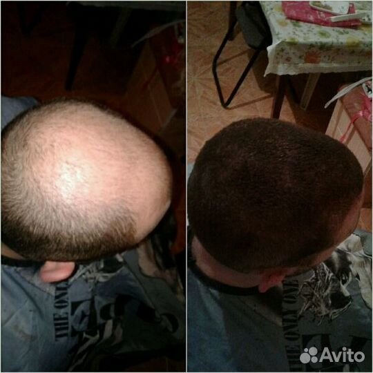 Загуститель волос