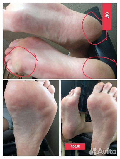 Маникюр педикюр