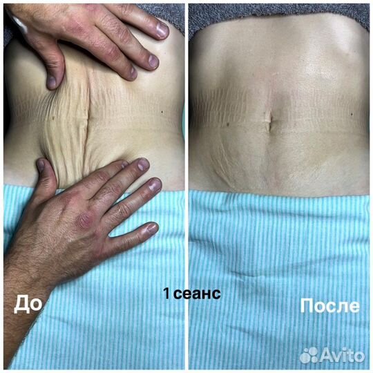 Восстановительный Массаж, Правка всего тела