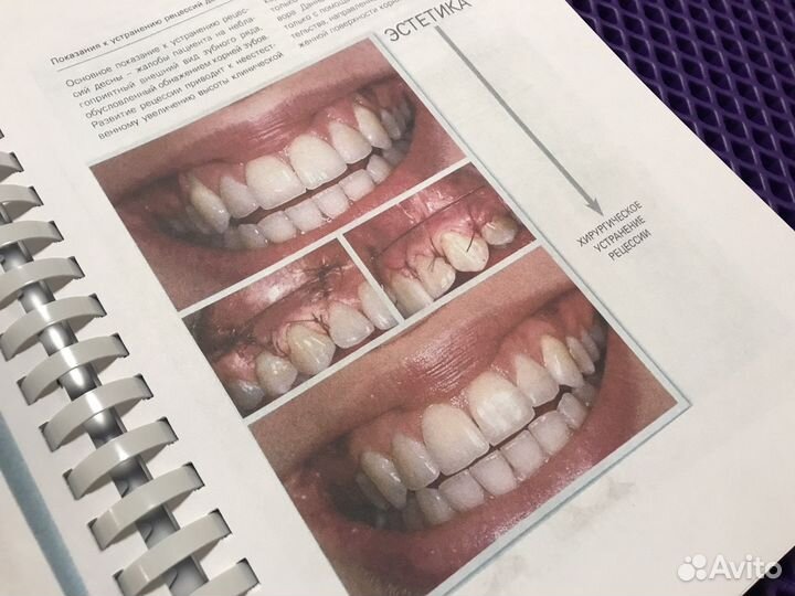 Пластическая хирургия мягких тканей полости рта