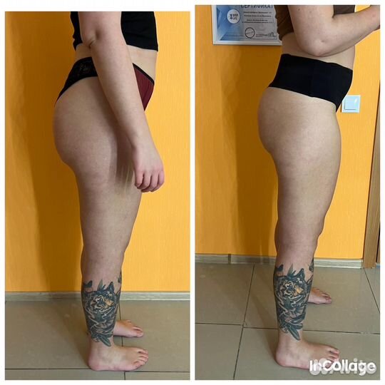 Аппаратный,вибрационно-роликовый массаж,кавитация