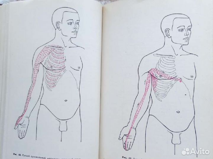 Книги по Иглоукалыванию, Массажу