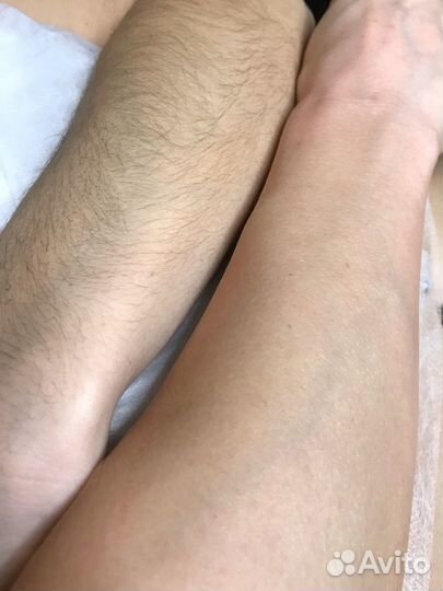 Шугаринг/воск