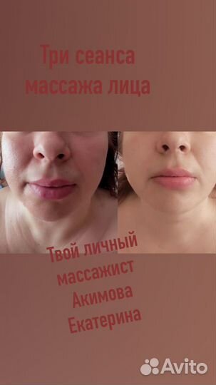 Ручная пластика лица