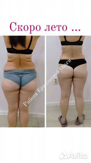 Массаж Антицеллюлитный аппаратный и ручной