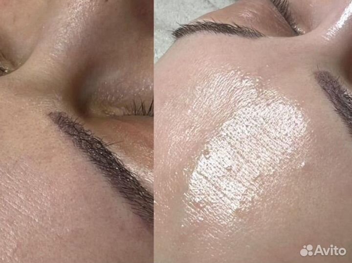 Отбеливающая маска для лица