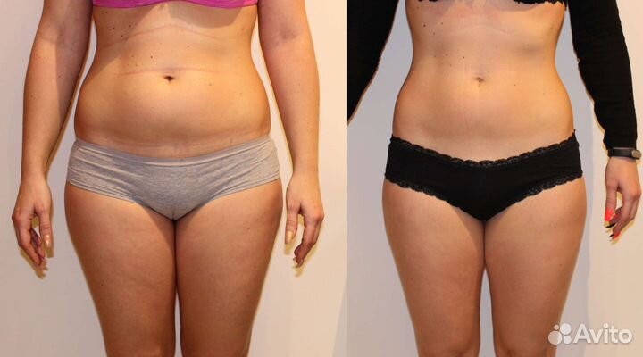 Модели на Кавитация боков