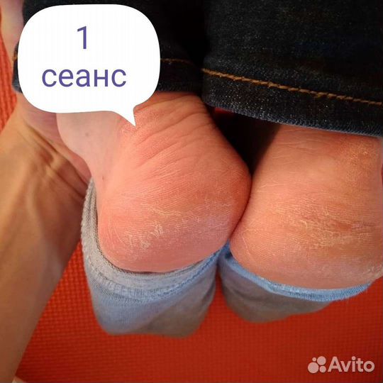 Исправлю сколиоз,осанку Ю Мей Хо массаж