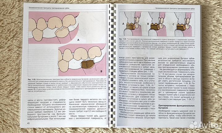 Основы препарирования зубов