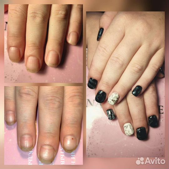 Покрытие гель лаком