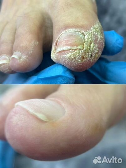 Услуги подолога