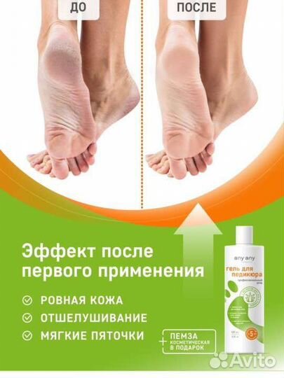 Средство для пяток ног