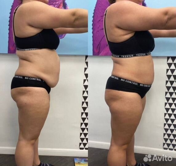 Кoмплекc для поxудения. «Стройный живот»