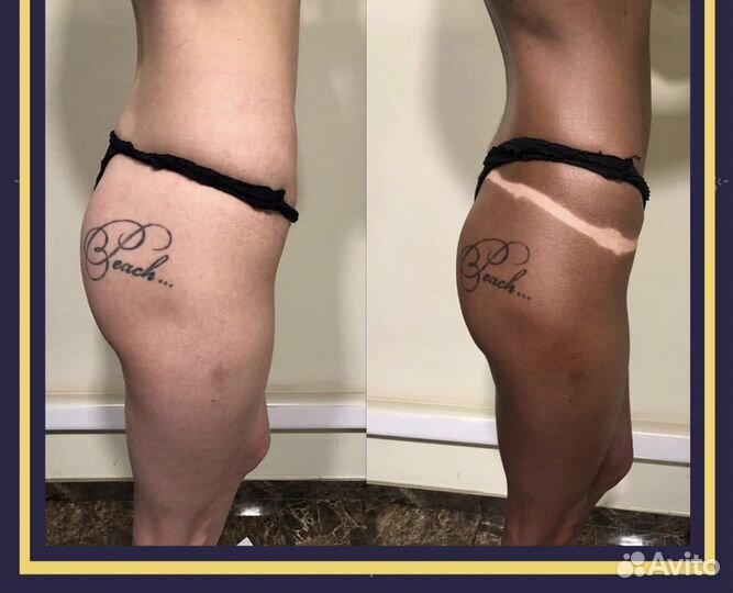 Моментальный загар