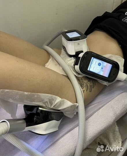 Модель на криолиполиз быстрое похудение