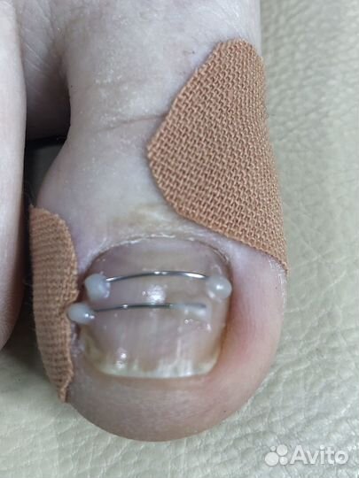 Подология и эстетика, выезд на дом