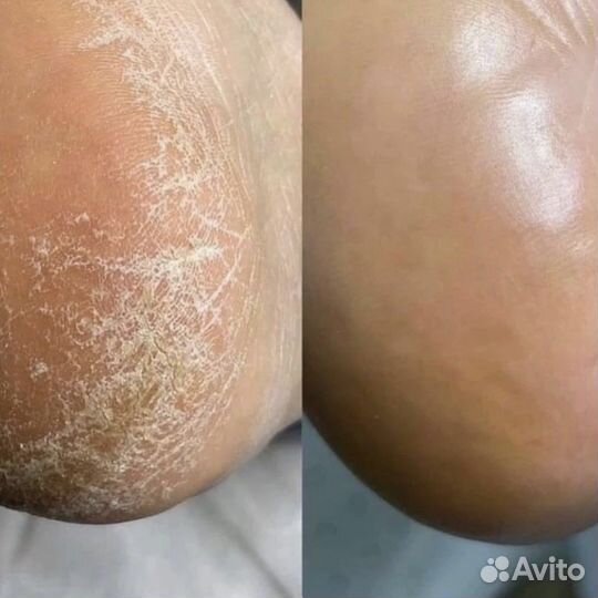 Педикюр Smart, Golden Trace