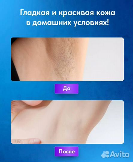 Фотоэпилятор