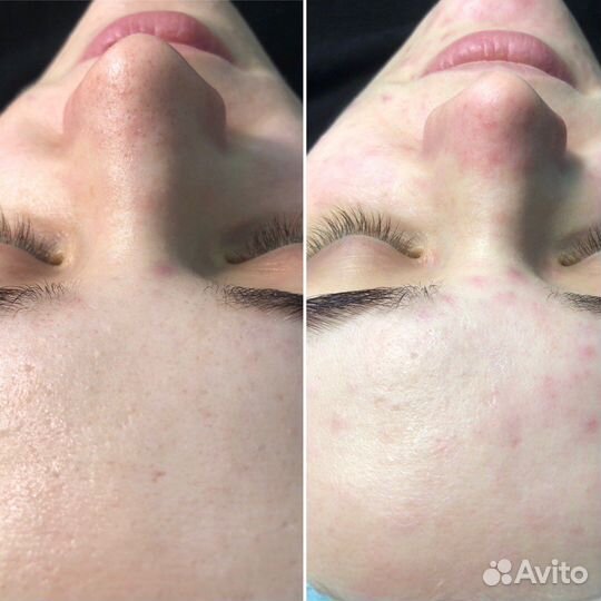 Услуги косметолога