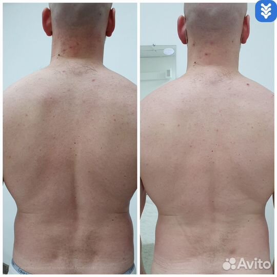 Массаж мануальный остеопат костоправ(м.Киевская)