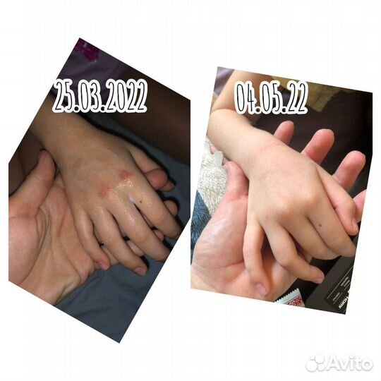 Энергетический массаж Access bars/ Аксесс барс