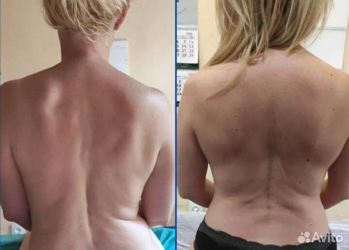 Лечебный массаж спины