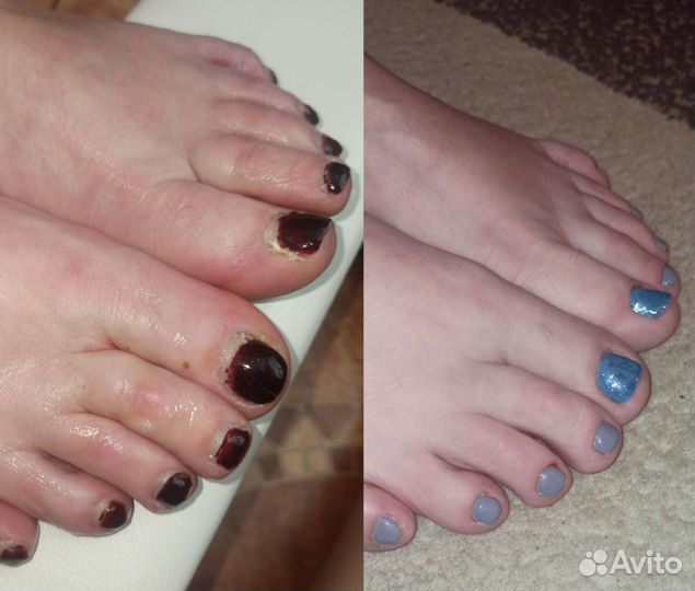 Маникюр, педикюр