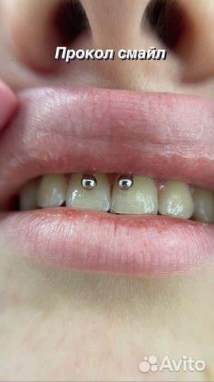 Пирсинг,прокол ушей с 1 года