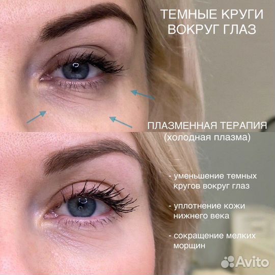 Холодная плазма процедуры обучение