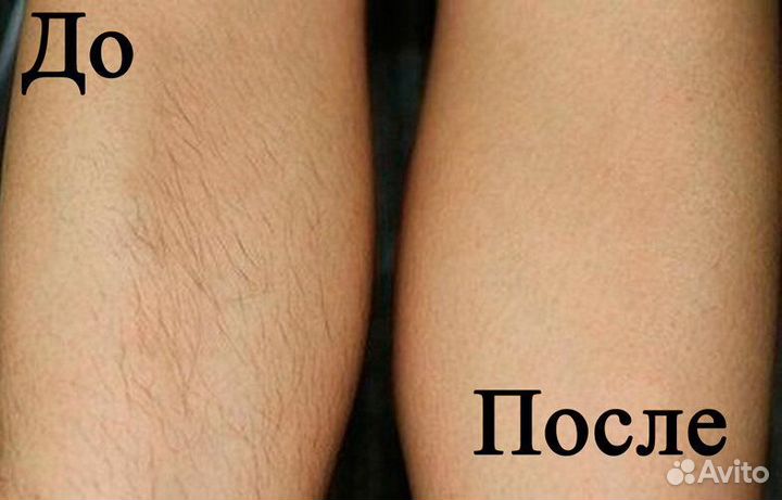 Шугаринг, ваксинг