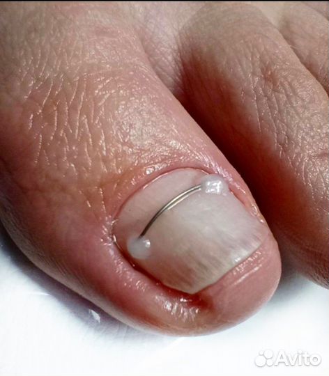 Подология и эстетика