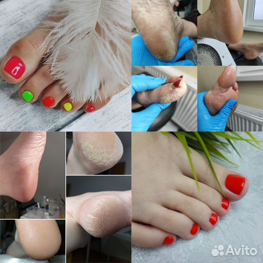 Педикюр