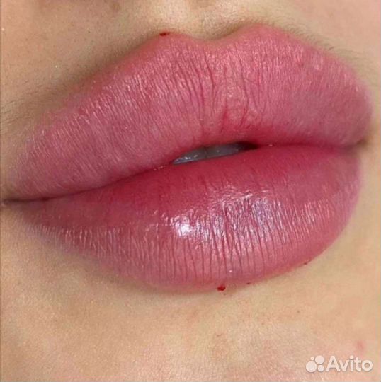 Косметолог, уколы красоты, ботокс,липолитик,пилинг