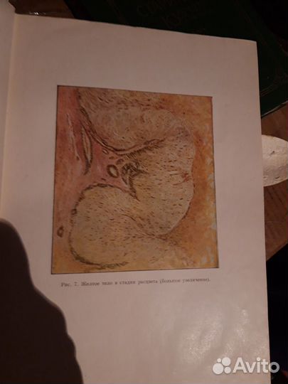 Гинекология