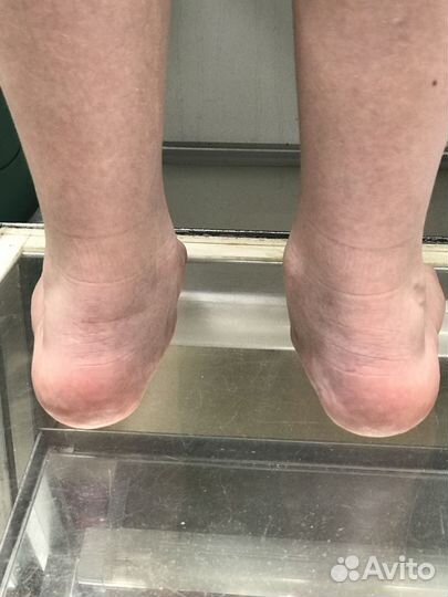 Стельки Ортопедических индивидуальные