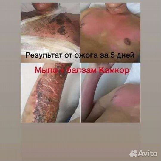 Бальзам камкор