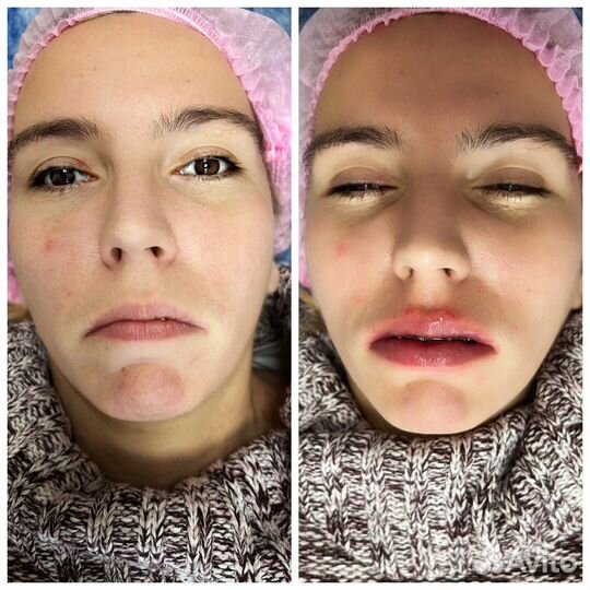 Услуги косметолога