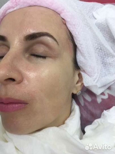 Скульптурный массаж лица