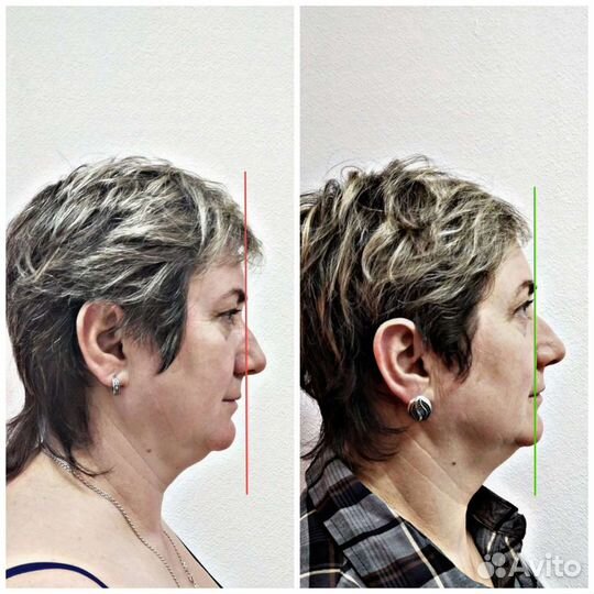 Восстановление естественной красоты