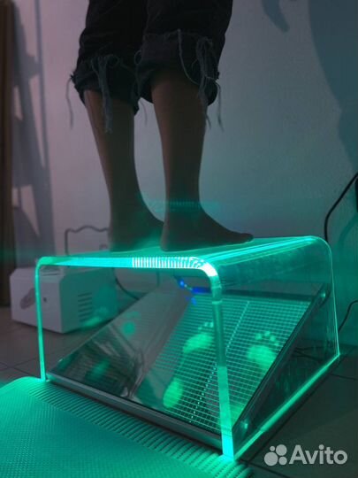 Коррекция плоскостопия. Ортопедические стельки