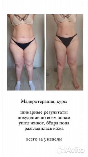 Мадеротерапия+ вибромассаж 5g