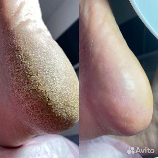 Маникюр, Smart педикюр, наращивание ногтей