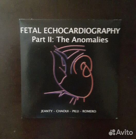 Уз-диагностика аномалий сердца плода. CD