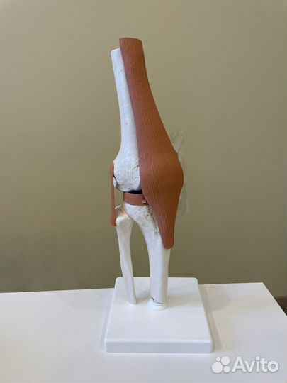 Модель коленного сустава