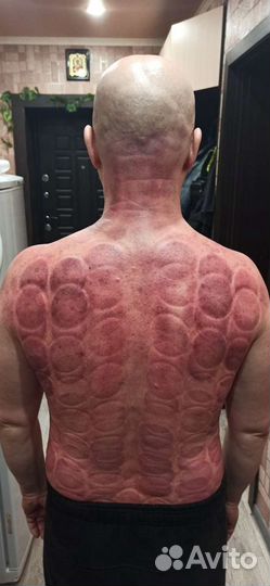 Правка тела