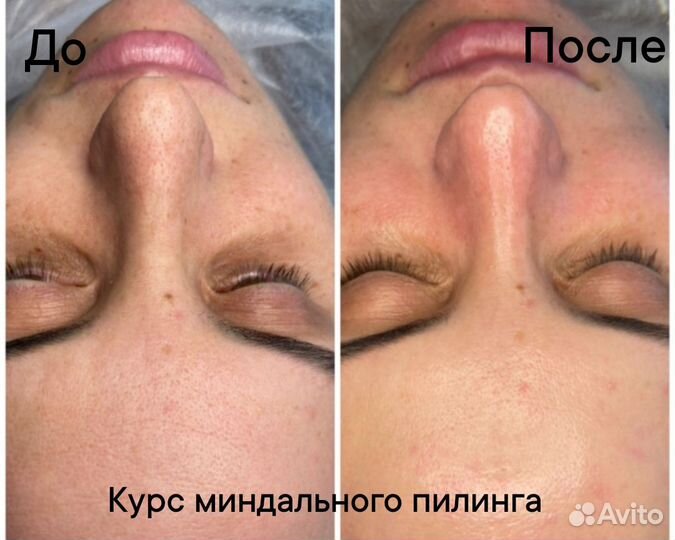 Косметолог эстетист